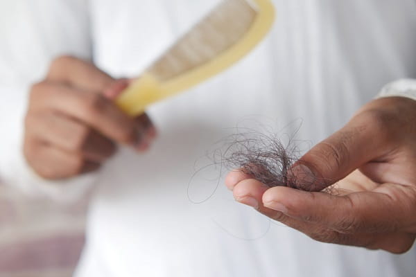 Hair Loss After Stress: Causes, Recovery Timeline & How to Regrow Your Hair;